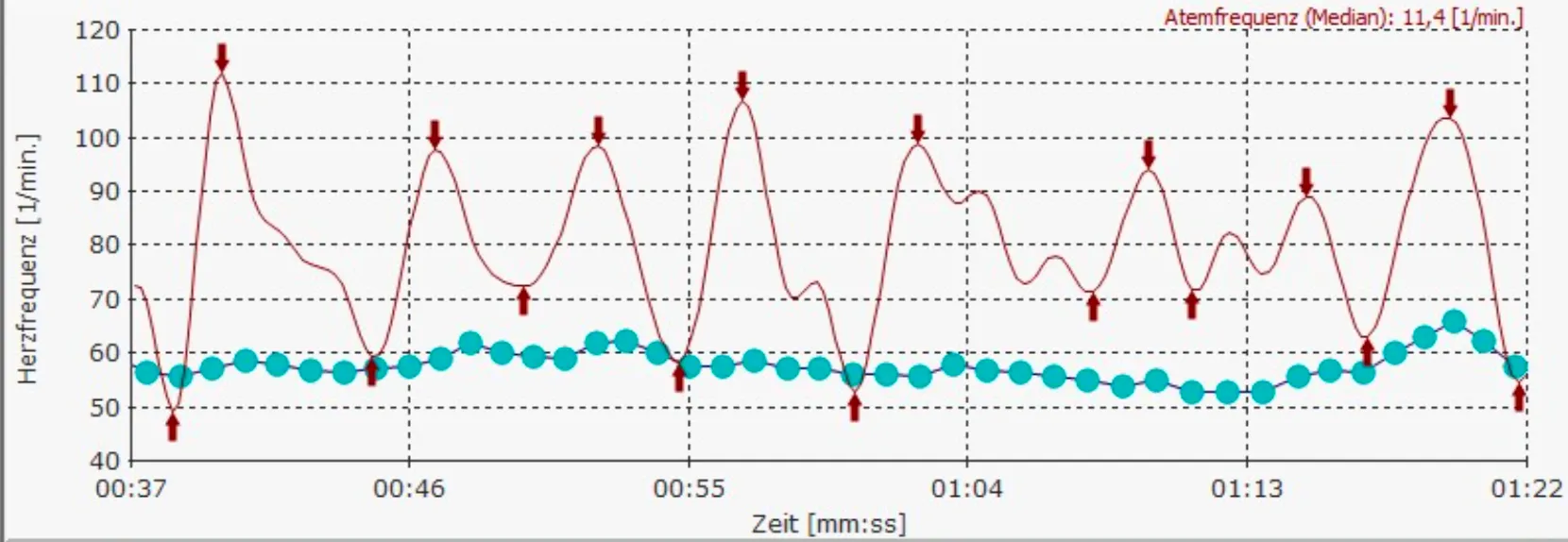 Beispielauswertung: Herzfrequenz im Verlauf mit Atemrhythmus