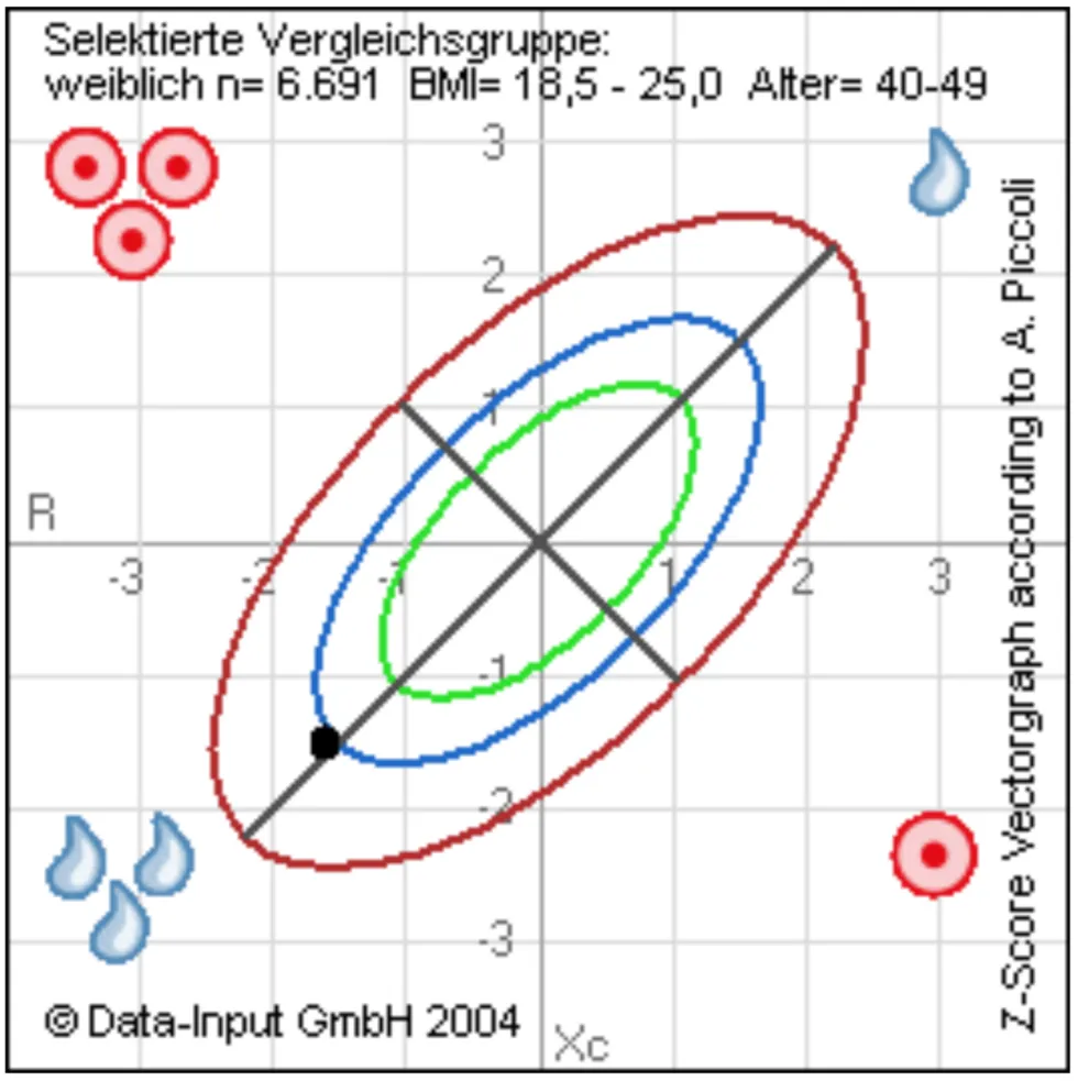 Beispiel eines Vektorgraphen aus der Körperanalyse